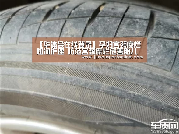 【华体会在线登录】孕妇宫颈糜烂如何护理 防范宫颈糜烂危害胎儿(图2)